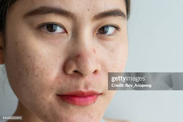 portrait of asian woman with acne and aging wrinkle occur on her face. natural skin of person without make-up. - woman face close up stock pictures, royalty-free photos & images