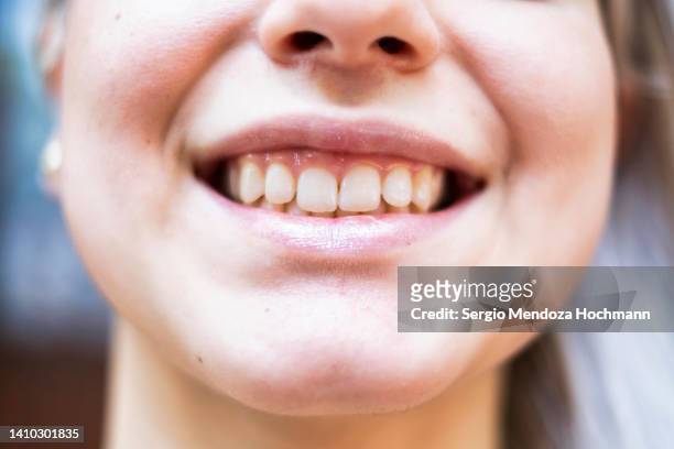 close up of teeth of young caucasian latino woman smiling - gingivitis stock-fotos und bilder