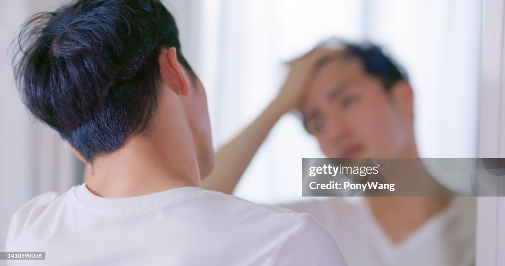 Hombre preocupado por la pérdida de cabello