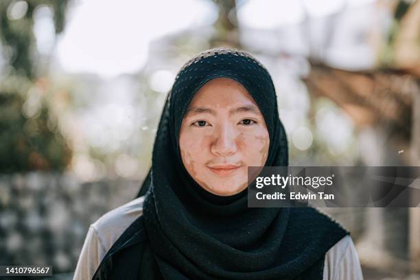 headshot asian malay woman in hijab with vitiligo skin condition looking at camera smiling at back yard garden in the morning - vitiligo stock pictures, royalty-free photos & images