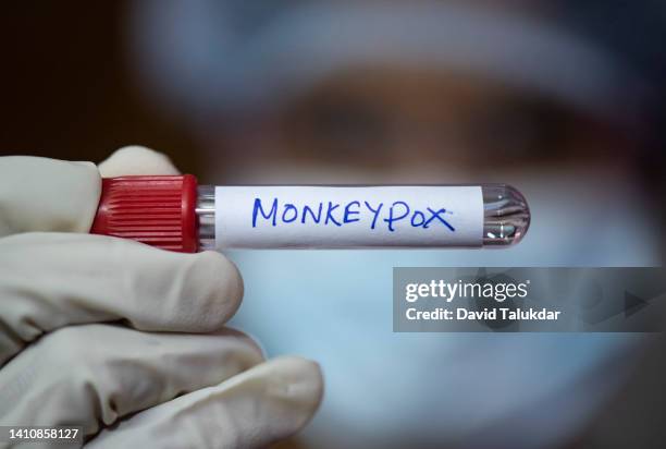 photo illustration of monkeypox virus - viruela del mono fotografías e imágenes de stock