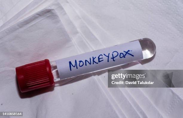 photo illustration of monkeypox virus - smallpox virus stock-fotos und bilder