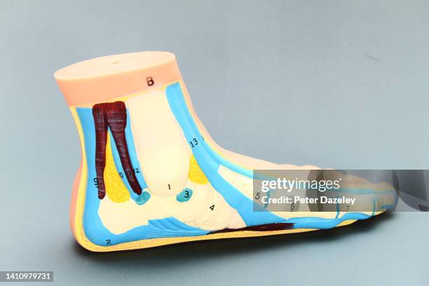 anatomical model of flat foot - diabetes feet stock pictures, royalty-free photos & images