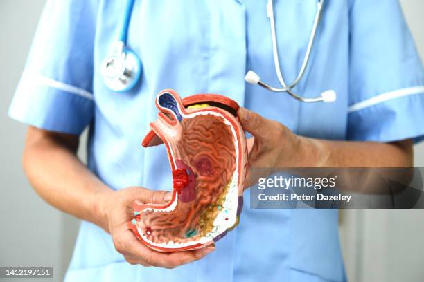 nurse/ doctor with teaching model of stomach - reflux stock-fotos und bilder