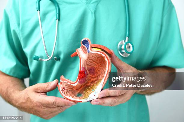 surgeon with teaching model of stomach - gastric ulcer stock pictures, royalty-free photos & images