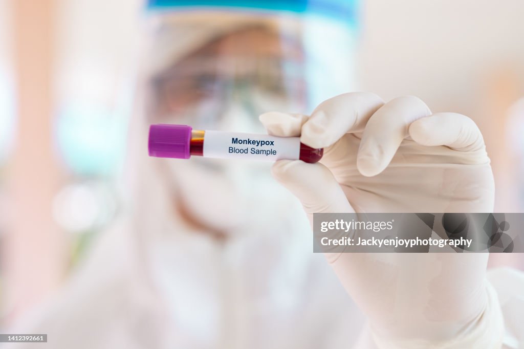 Monkeypox virus blood sample