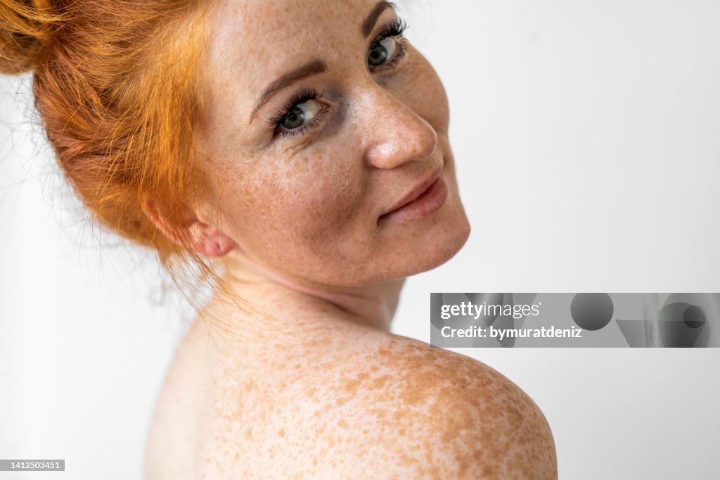 Woman with freckles