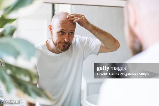 young adult bearded man looking in mirror in bathroom touching head worried about about hair loss - baldness stock-fotos und bilder