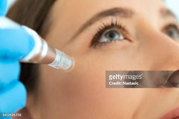 dermapen skin needling treatment on a patient  skin - pierced stock pictures, royalty-free photos & images
