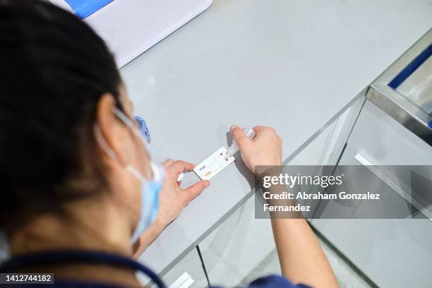 veterinarian using a rapid test kit for detection of feline leukemia virus and feline immunodeficiency virus of a domestic cat before an operation - dépistage des cancers photos et images de collection