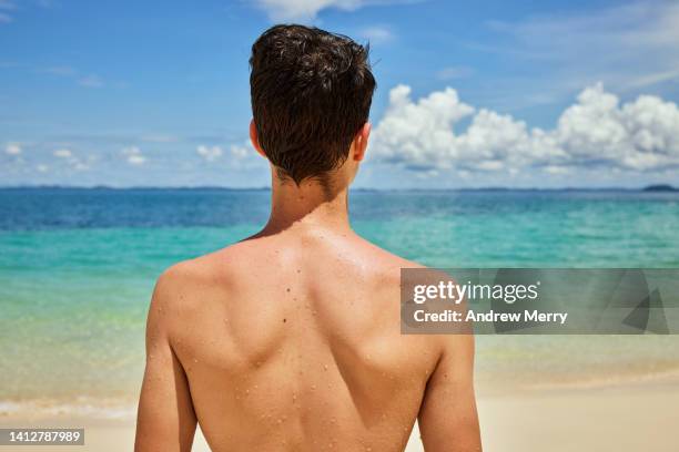 swimmer at beach, teenage male back and shoulders - sunburn tourist stock-fotos und bilder