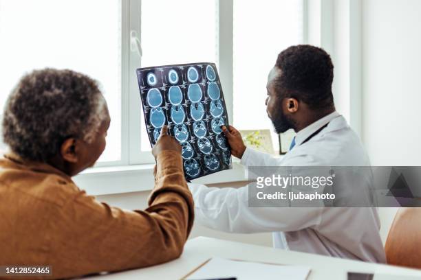 young doctor man looking x-ray of the patient's skull - skull xray no brain stock pictures, royalty-free photos & images