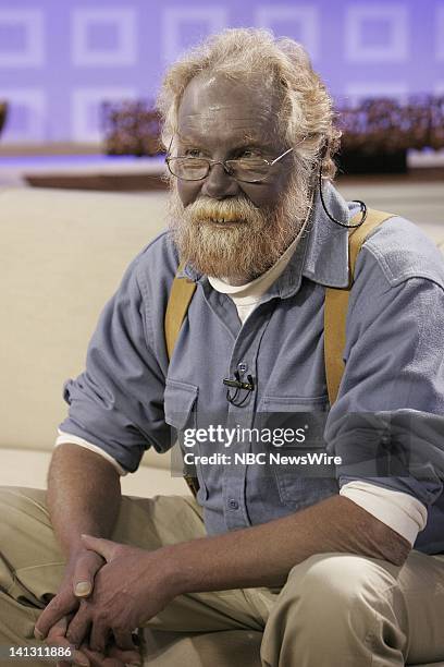 Air Date 1/7/08 -- Pictured: Paul Karason talks exclusively with NBC News' "Today" about turning permanently blue after using colloidal silver on...