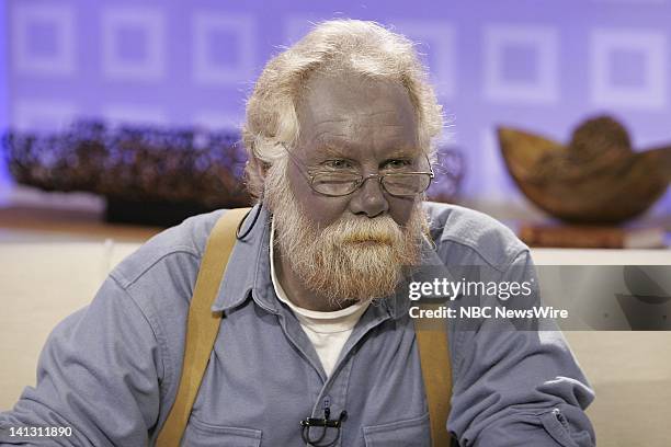 Air Date 1/7/08 -- Pictured: Paul Karason talks exclusively with NBC News' "Today" about turning permanently blue after using colloidal silver on...