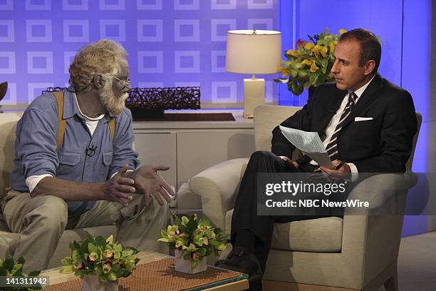 Air Date 1/7/08 -- Pictured: Paul Karason talks exclusively with NBC News' "Today" co-anchor Matt Lauer about turning permanently blue after using...