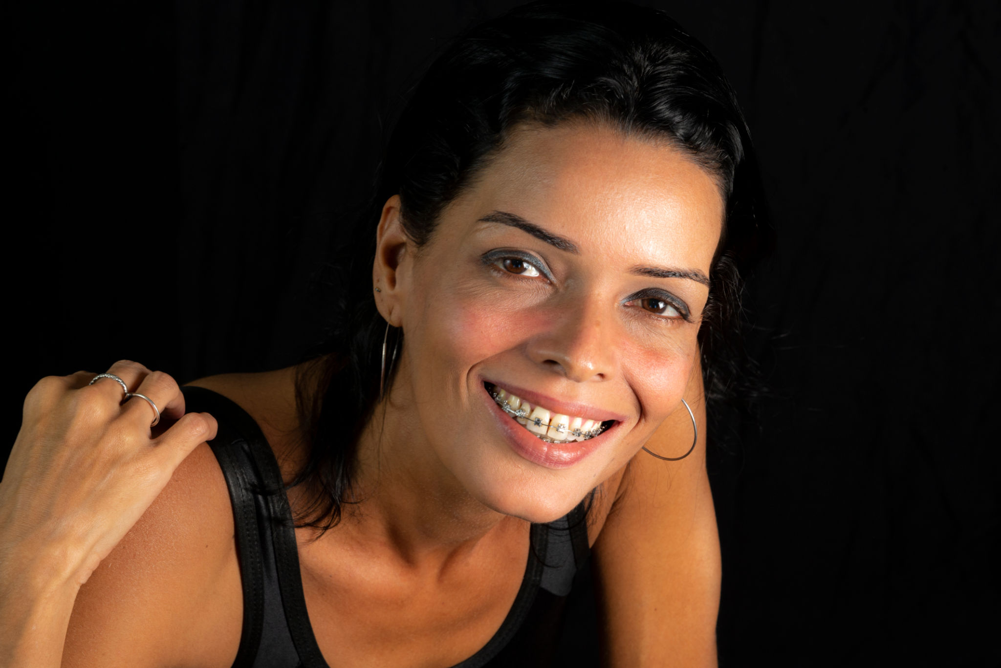 ortodonzia sorriso