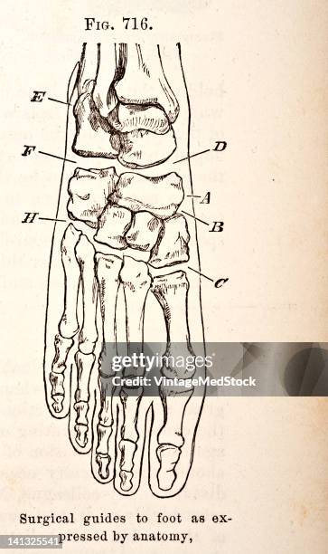 Medical engraving from A Manual for the Practice of Surgery illustrates the skeletal structure of the human foot, 1881.