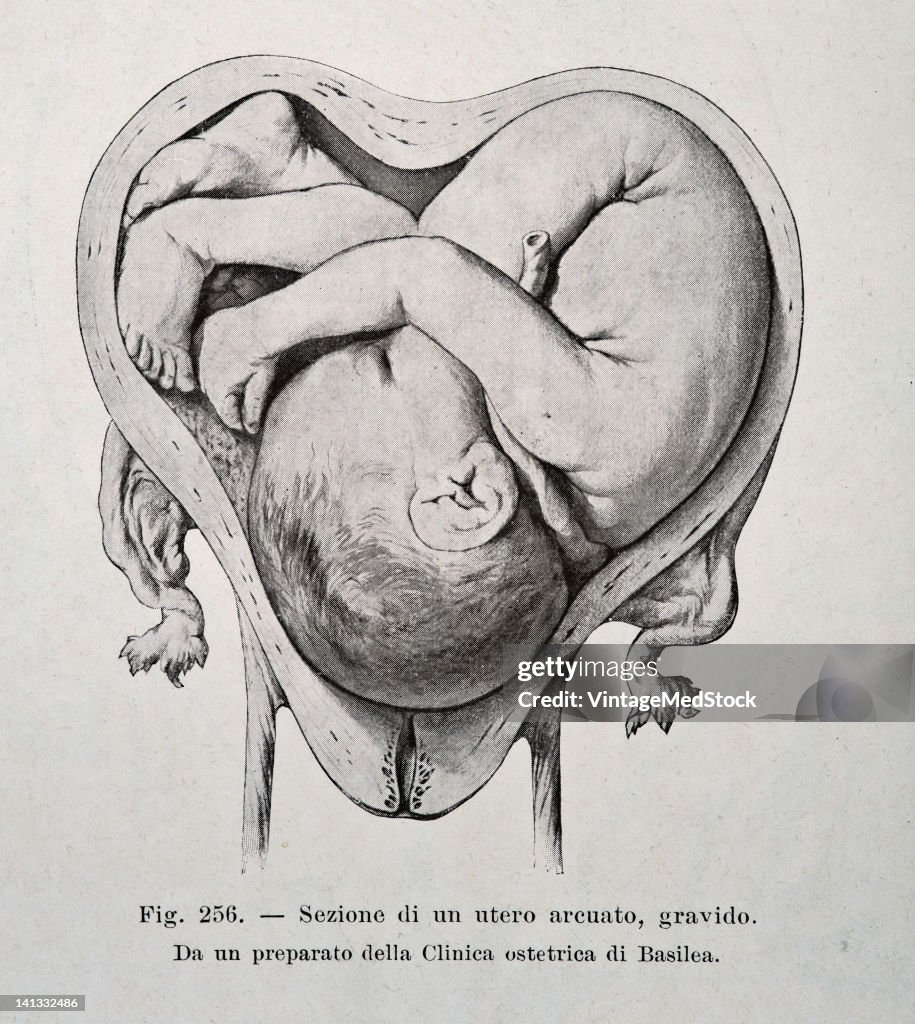 Fetal Attitude