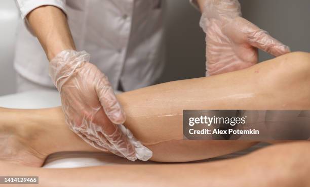 dermatologist is preparing woman's leg for laser hair removal. close-up. - dead female bodies stock pictures, royalty-free photos & images