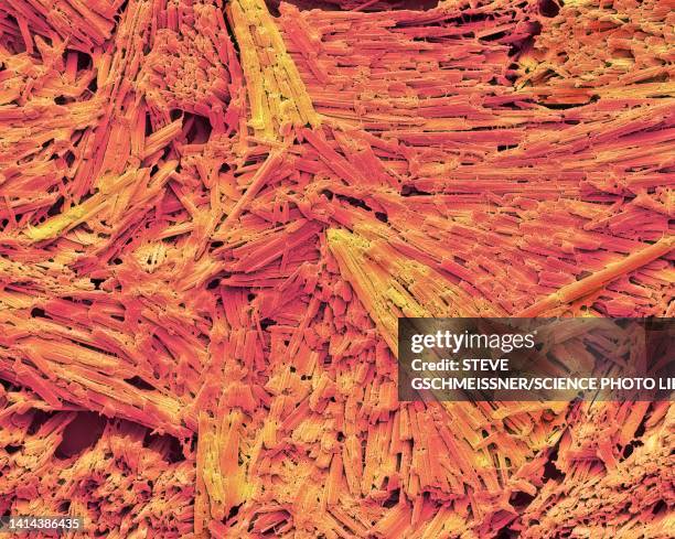 uric acid crystals in gout, sem - gout stock pictures, royalty-free photos & images