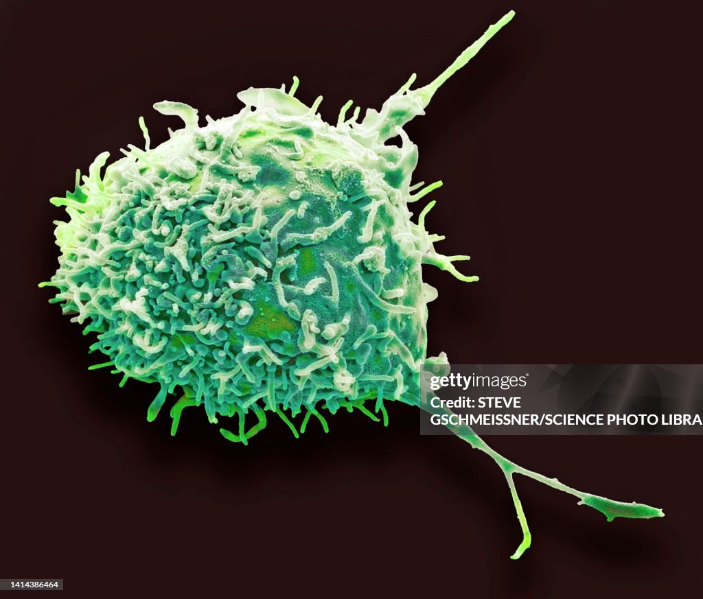 Mesenchymal stem cell, SEM
