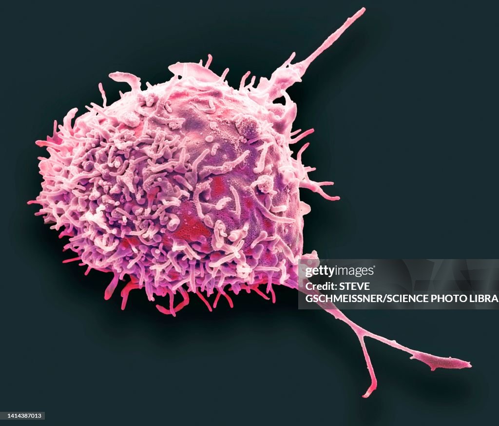 Mesenchymal stem cell, SEM