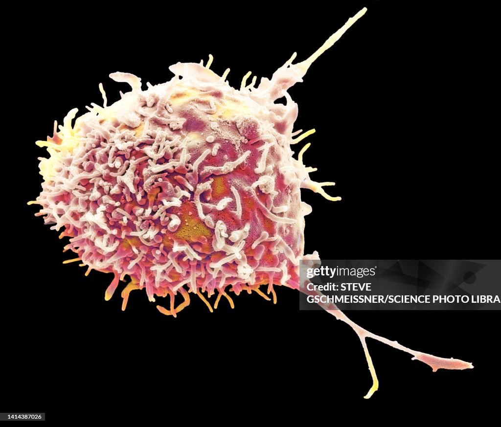 Mesenchymal stem cell, SEM