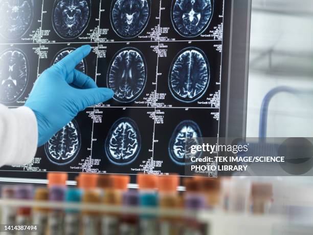 alzheimer's and dementia research, conceptual image - demens bildbanksfoton och bilder