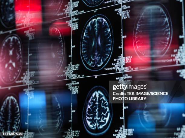 alzheimer's and dementia research, conceptual image - neurodegenerative disease stock pictures, royalty-free photos & images