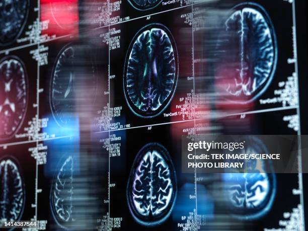 alzheimer's and dementia research, conceptual image - ziekte van alzheimer stockfoto's en -beelden