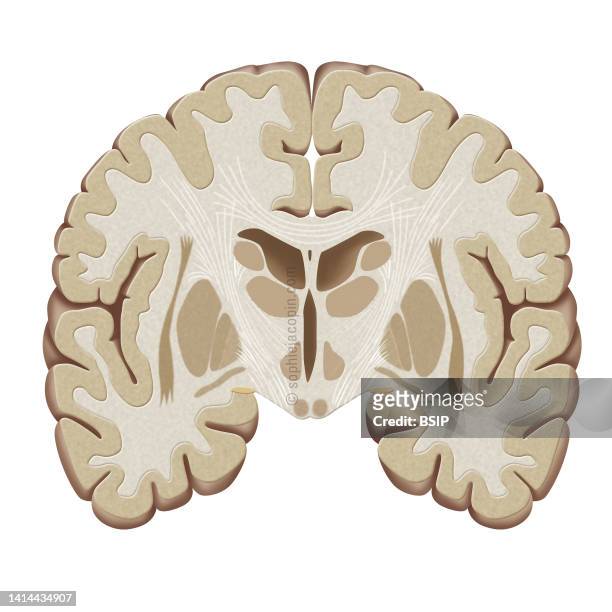 Brain, frontal cut in front of the brainstem. Representation of a section of the brain in front of the brainstem. Also called coronal cut or Charcot...