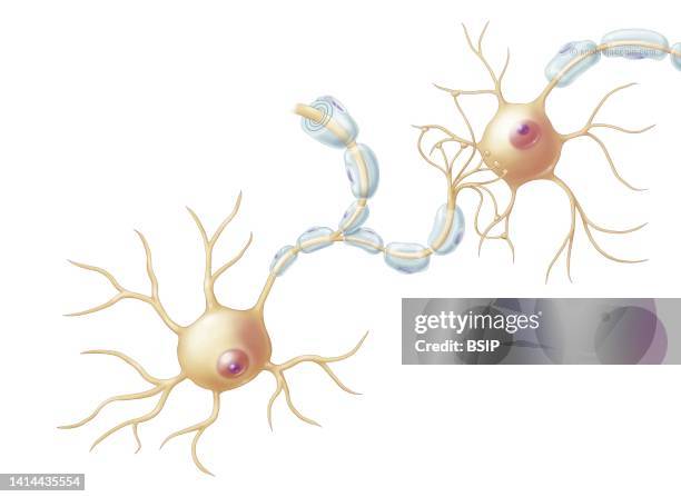 Structure of neuron, cell body, axon, dendrites, synapses, synaptic button. The neuron is made up of several structures. The cell body in yellow has...