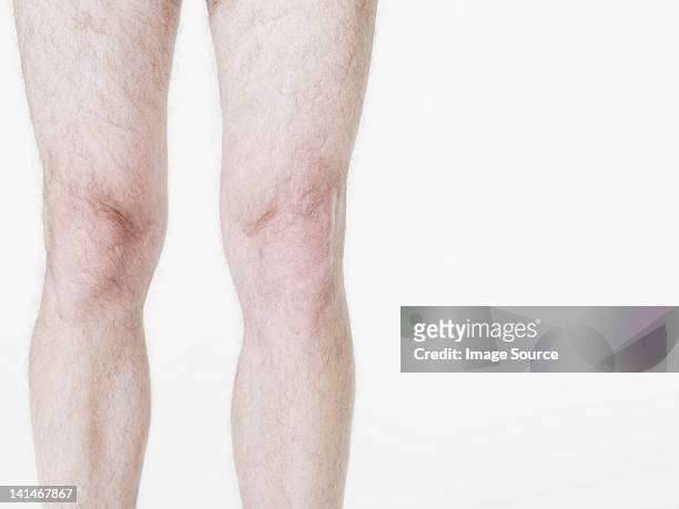 737 Man Leg Hair Photos and Premium High Res Pictures - Getty Images