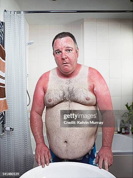 sunburn blue collar - coup de soleil photos et images de collection