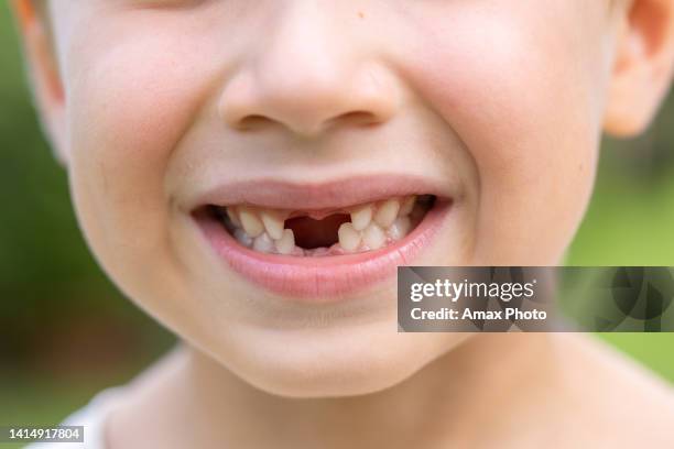 close-up portrait of smiling school-aged gap toothed kid boy with missing four front teeth - kid missing teeth stock pictures, royalty-free photos & images