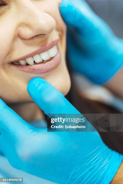 controllo dentistico - esame della bocca e dei denti dei pazienti - sbiancamento dentale foto e immagini stock