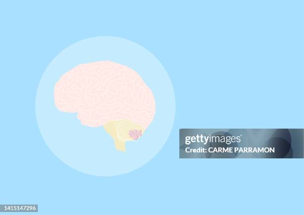 brain cancer - functional magnetic resonance imaging brain stock illustrations