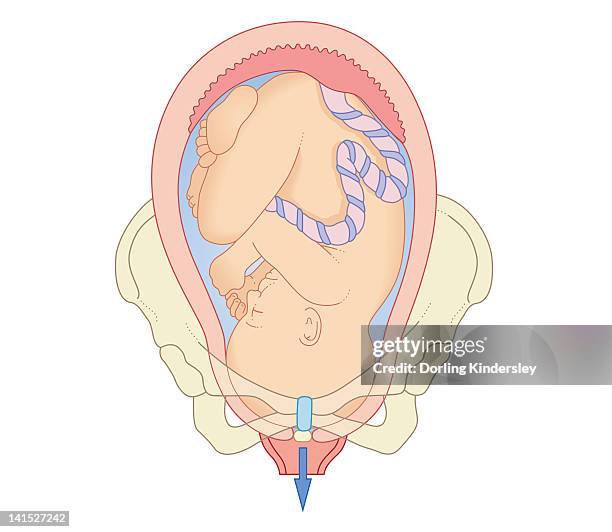 cross section biomedical illustration of position foetus in pelvis at first stage of labour - placenta 幅插畫檔、美工圖案、卡通及圖標