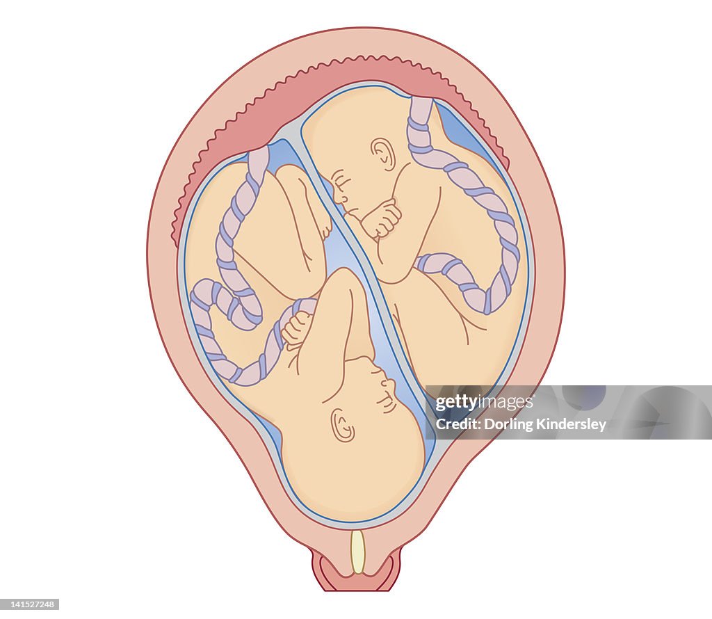 Cross section biomedical illustration of identical twins in uterus sharing placenta