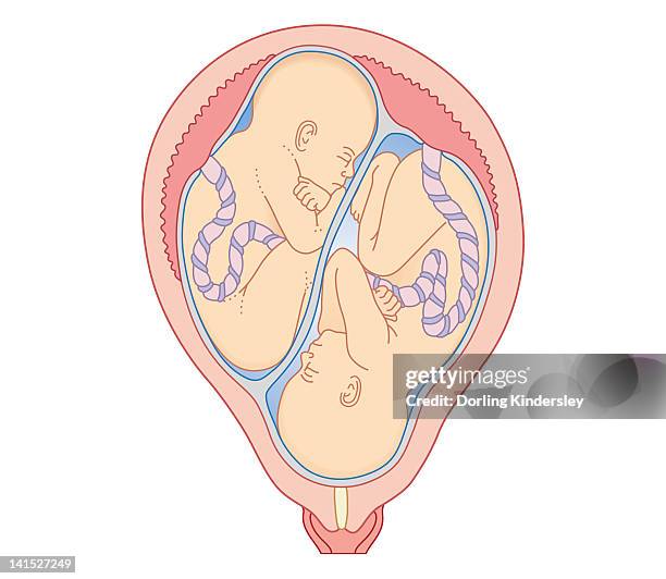 cross section biomedical illustration of non identical twins in uterus with separate placentas - non identical twins stock illustrations