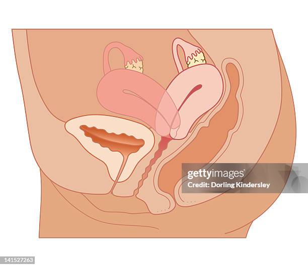 bildbanksillustrationer, clip art samt tecknat material och ikoner med cross section biomedical illustration of retroverted uterus - äggledare