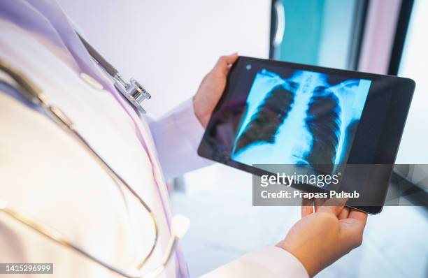 lung cancer concept. doctor explaining results of lung check up from x-ray scan chest on digital tablet screen to patien - lung cancer stockfoto's en -beelden
