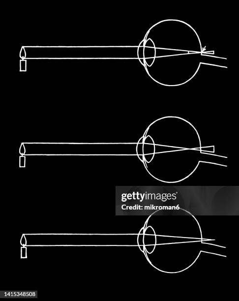 old engraved illustration of anatomy of the human eye, healthy eye, myopia and hyperopia - nerf optique photos et images de collection