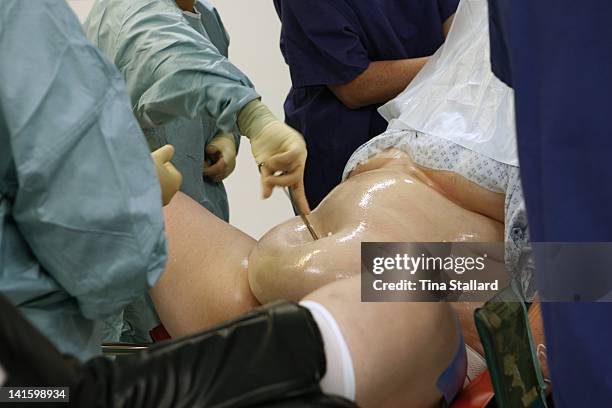 Hospital staff prepare to carry out stomach surgery on an anonymous woman, 42. She is having a gastric band fitted at a private hospital, Spire...