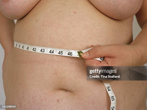 An anonymous woman before her weight loss surgery. She weighs nearly 20 stone and is severely obese. She hopes to lose around a third of her weight...