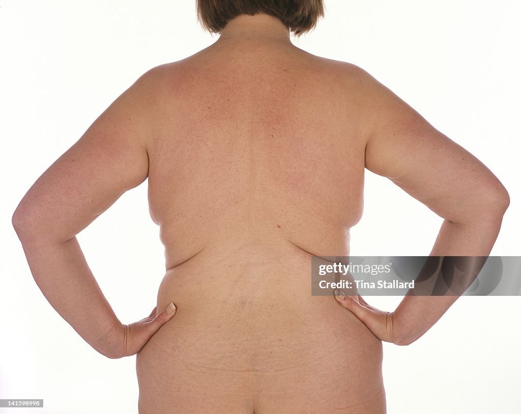 Gastric Band Treatment