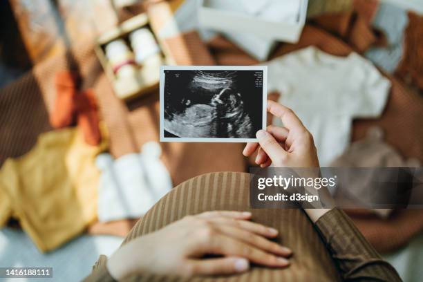 personal perspective of asian pregnant woman looking at an ultrasound scan photo while gently touching her baby bump, with baby clothings and accessories laying on the floor. mother-to-be. preparation for a new family member. expecting a new life concept - infertilidad fotografías e imágenes de stock