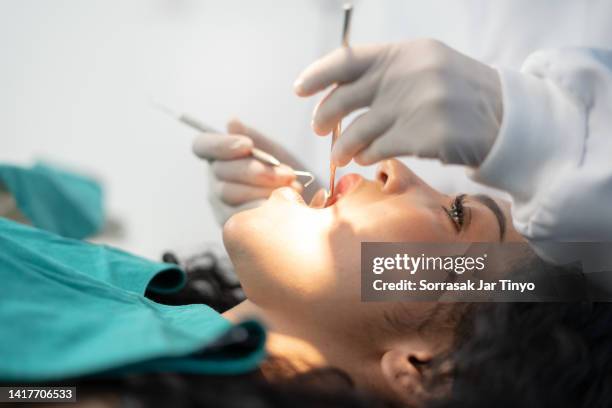 young women having routine check her teeth at dental clinic - dentist's chair stock pictures, royalty-free photos & images