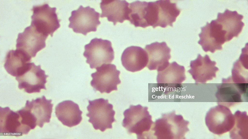 CRENATED ERYTHROCYTES (RED BLOOD CELLS) that were placed in a HYPERTONIC SALT SOLUTION (5% NaCl) 600X