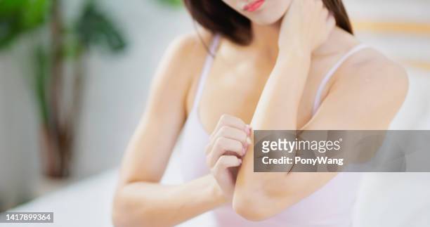 girl itching arm - skin fungus stock pictures, royalty-free photos & images